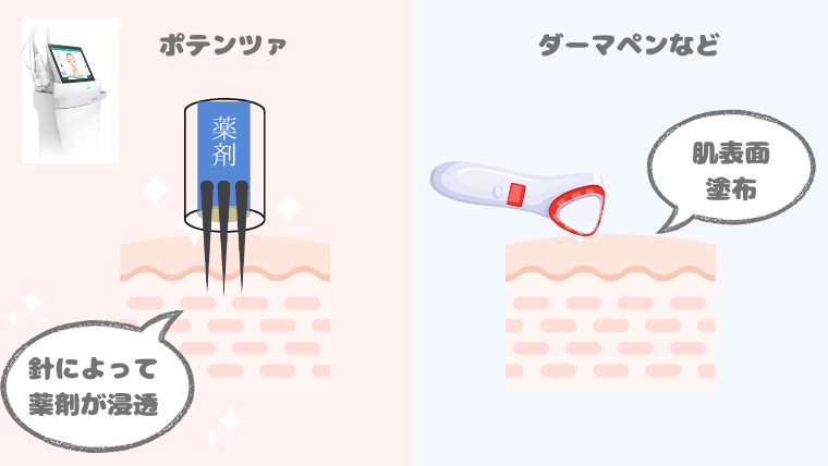 ポテンツァ・ドラッグデリバリーの仕組み