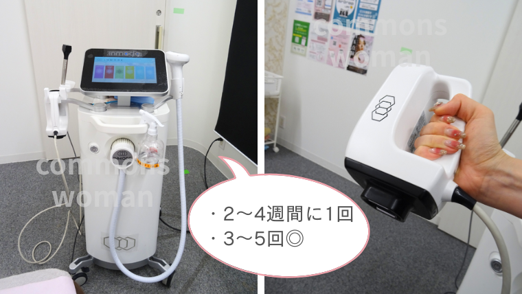 ルラ美容クリニックのインモードの間隔、回数