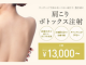 TCBの肩ボトックス