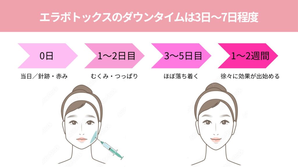 エラボトックスのダウンタイム