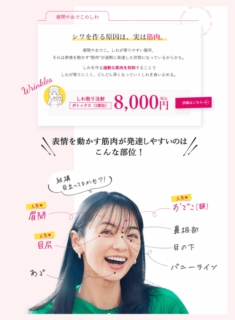 SBC湘南美容クリニックボトックスの料金