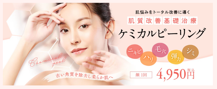 SBC湘南美容クリニックのケミカルピーリング