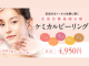 SBC湘南美容クリニックのケミカルピーリング