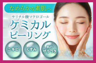 品川美容外科のケミカルピーリング