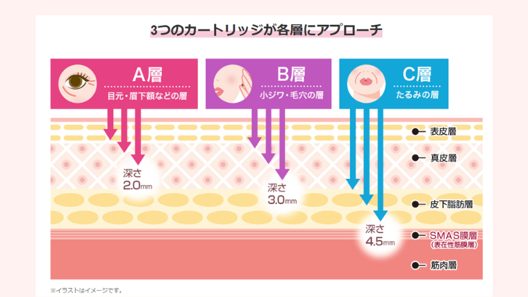 ソノクイーンハイフ