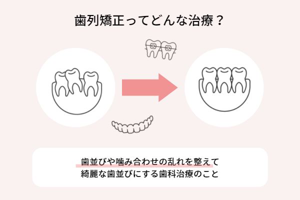 歯列矯正とは