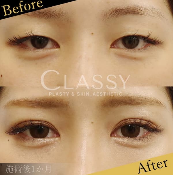 CLASSY仙台美容外科・美容皮膚科