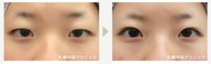 札幌中央クリニック症例写真