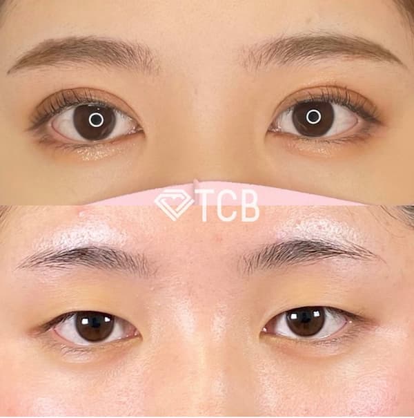 TCB東京中央美容外科