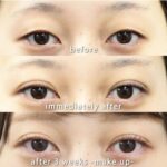 共立美容外科症例写真