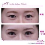 あいち栄クリニック症例写真