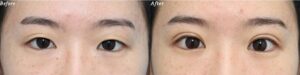 ヴェリテクリニック症例写真