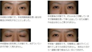 札幌美容形成外科症例写真