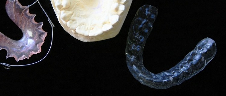 八重歯の治療におすすめのマウスピース矯正5選