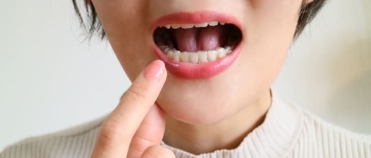 前歯だけのマウスピース矯正ができるオススメ歯科医院5選