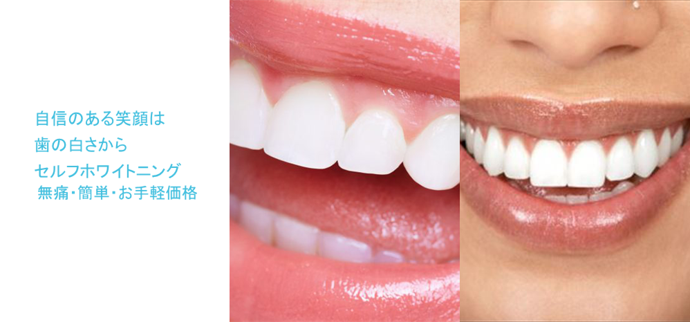 博多駅セルフホワイトニング スマイルワン博多駅店