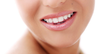 板橋 ホワイトニング