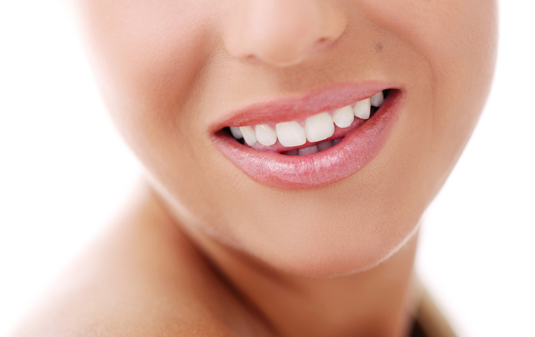 板橋 ホワイトニング