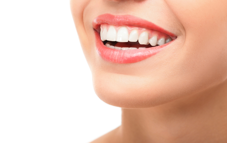 糸島市 ホワイトニング