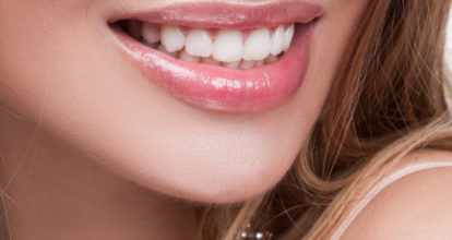 岩出市　ホワイトニング