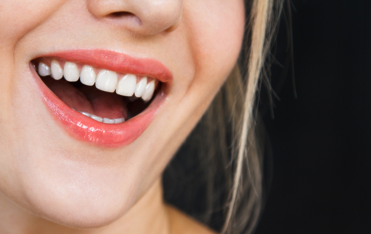 国分寺 ホワイトニング