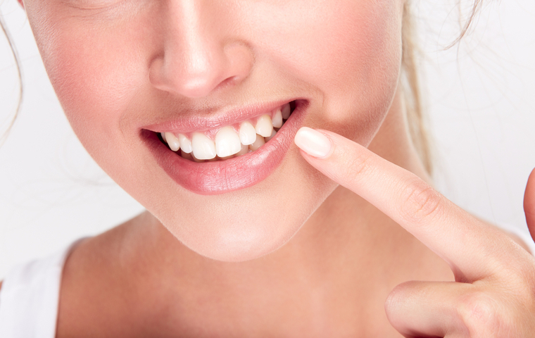 緑区　ホワイトニング