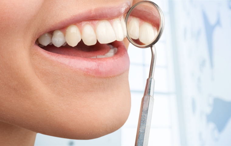 大垣市　ホワイトニング