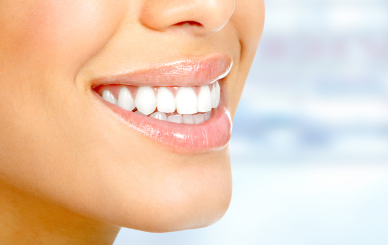 岡崎市　ホワイトニング