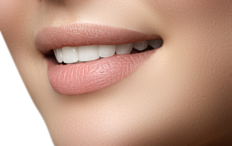 陸前高砂 ホワイトニング