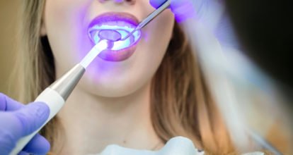 ホワイトニング治療受ける女性