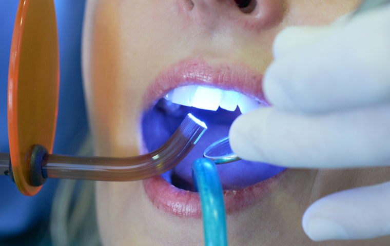 ホワイトニング治療受ける女性