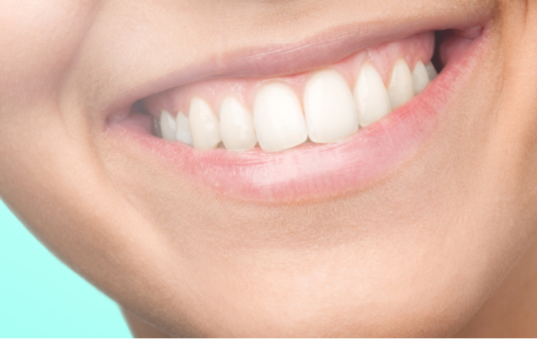 歯の白い女性