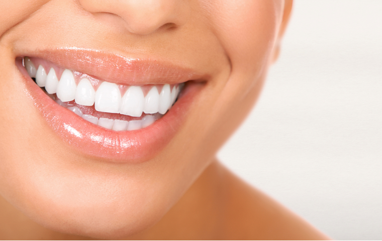 歯の白い女性