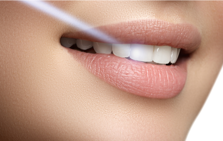 歯の白い女性