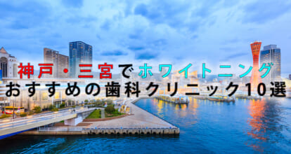 神戸・三宮でホワイトニングにおすすめの歯科クリニック10選【2021年版】