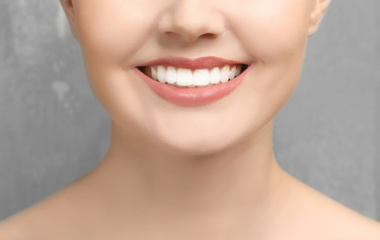 山科区 ホワイトニング